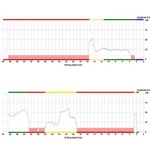 Profili resistograph